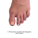 ricostruire parti di lamina mancante;