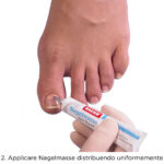 levigare unghie striate (con scanalature);