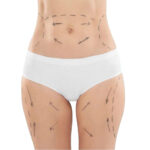 <strong><br /><img style="display: block; margin-left: auto; margin-right: auto;" src="https://cdn.shopify.com/s/files/1/0591/3834/3118/files/iside_480x480.jpg?v=1628252979" alt="" data-mce-fragment="1" /><br />SNELLABELLA - TISANA RIMODELLANTE<br /></strong><i>Effetto snellente